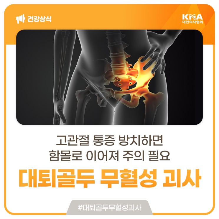  대퇴골두 무혈성 괴사, 고관절 통증 방치하면 함몰로 이어져 주의 필요