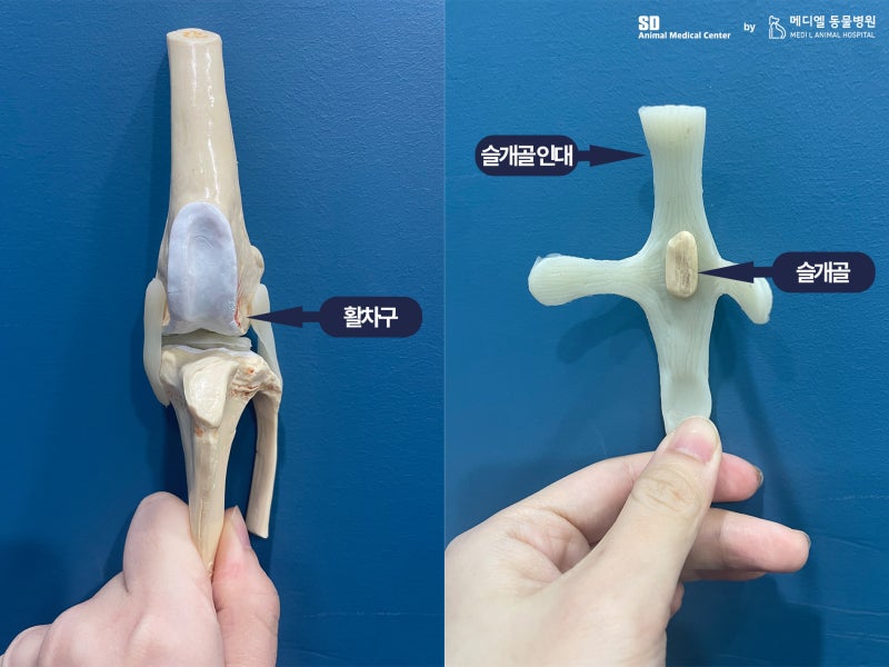 슬개골 탈구 설명 이미지