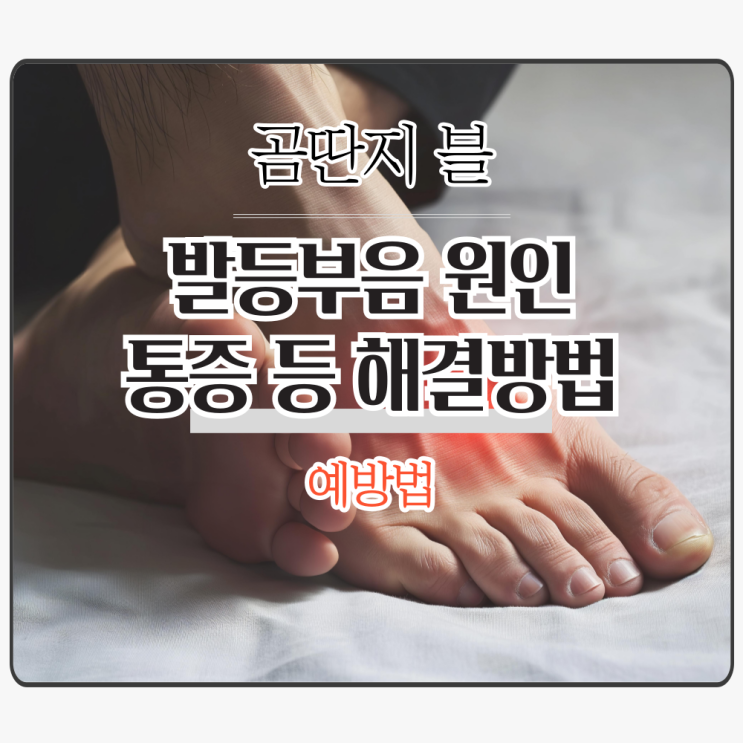  발등 부음 원인과 통증 원인은?해결방법 예방법