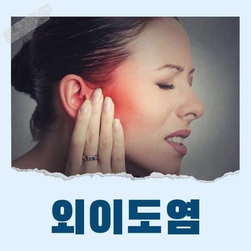 외이도염 약 연고 약국 뭐가 좋을까?