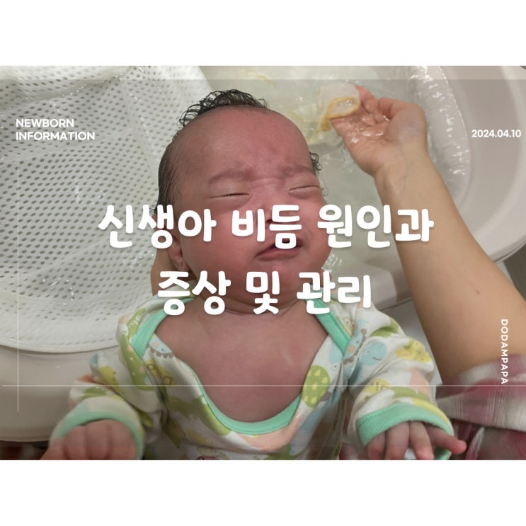 신생아 비듬 원인과 증상 및 관리 신생아 두피 신생아두피각질 신생아 비듬 원인과 증상 및 관리 신생아 두피 신생아두피각질