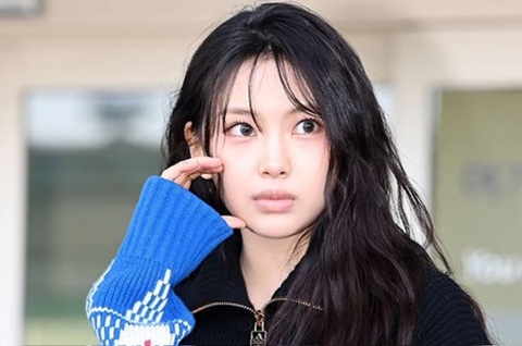 <b>뉴진스 혜인</b>, 컴백 앞두고 안타까운 소식 "<b>골절</b> 발견해 당분간... 