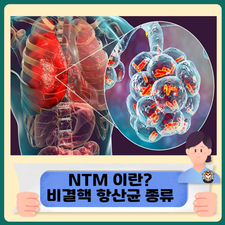 비결핵항산균 폐질환이란 NTM 종류