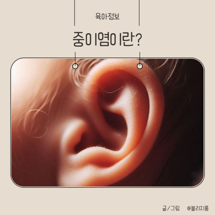  아기 중이염의 원인과 관리방법