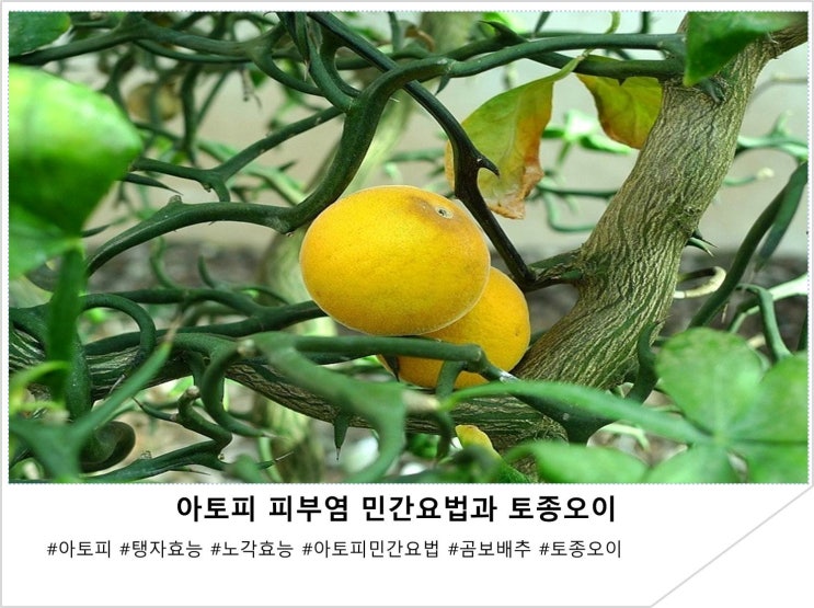  아토피 피부염 민간요법과 토종오이