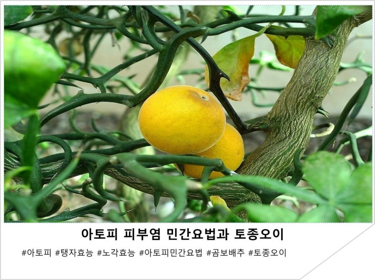 아토피 피부염 민간요법과 토종오이