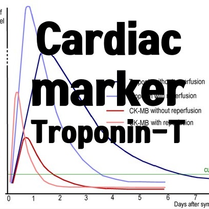  Troponin-T (트로포닌-T)의 검사목적과 이유에 대해서 알아봐요~