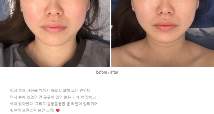  서면에스테틱-약손명가 프리미엄브랜드 달리아스파 부산서면점 리뷰 by.nnonnent님