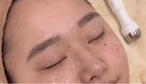  청주피부관리 산남동 뷰티다룸 | 아이돌V리프팅 솔직후기