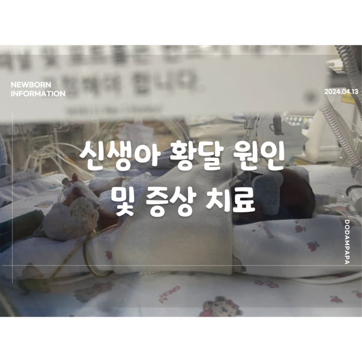 신생아 황달 원인 및 증상 치료 이른둥이 황달 신생아 황달 원인 및 증상 치료 이른둥이 황달