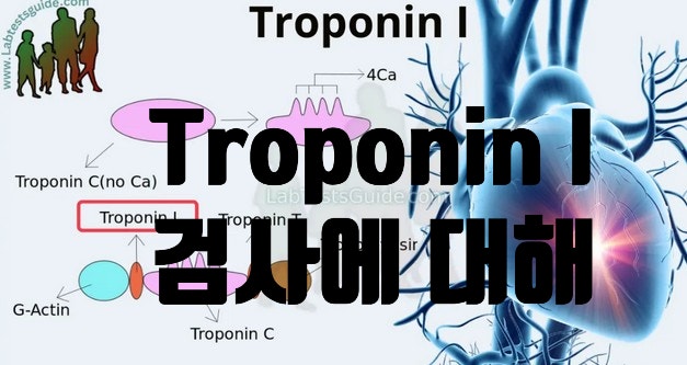  Troponin I 검사의 이유와 목적에 대해서 알아봐요~