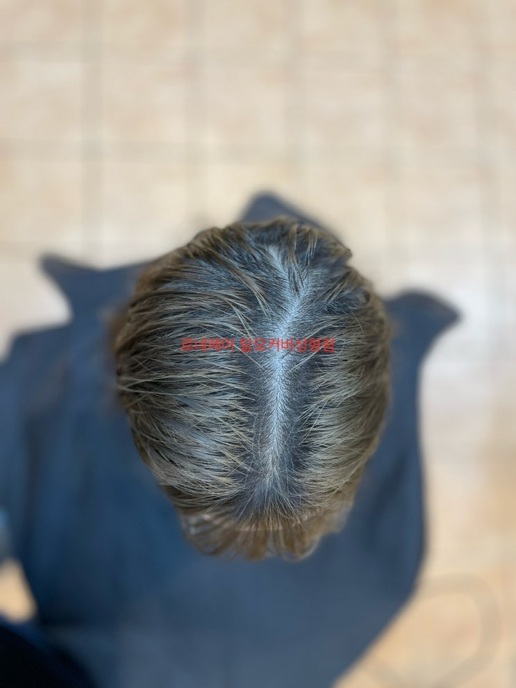  부산탈모관리전문미용실 르네시떼6층 이것이 진정 탈모펌이다. 여성탈모펌/ 컷 펌 염색 클리닉