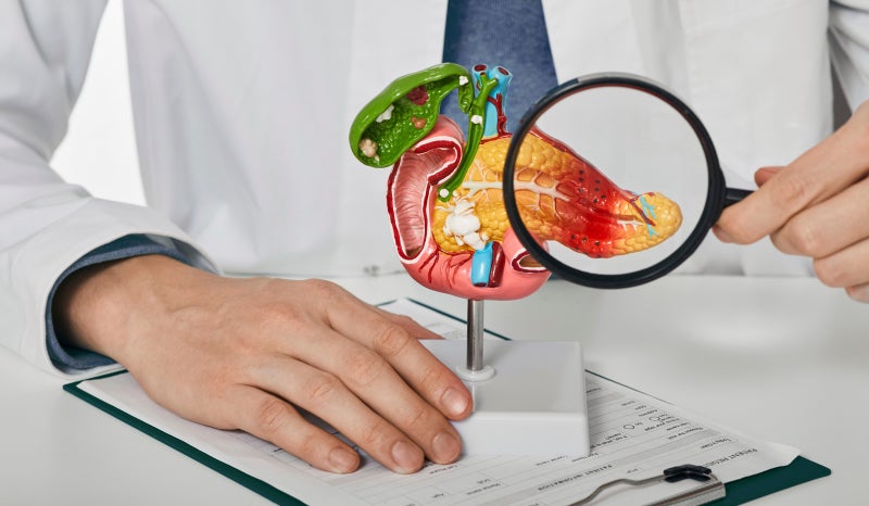의학용어 ERCP 정의와 목적, 주의사항은? (췌장담도내시경시술) : 네이버 블로그