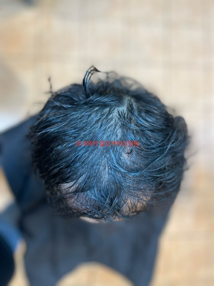  부산탈모관리전문 르네시떼사상미6층미용실 탈모성형펌과해독컬러 콜라보/ 감전주례학장구덕개금당감진구서면전포부전양정망미수영광안대연해운대남천용호민락연산동래사직온천화명명지김해양산거제창원밀양