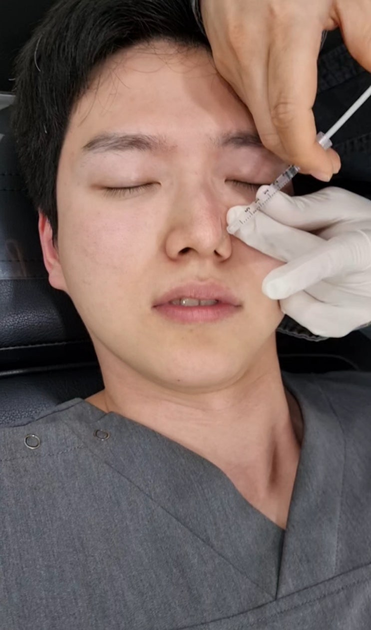  의사가 직접 맞고 쓰는 코 모공, 스킨/모공 보톡스 후기