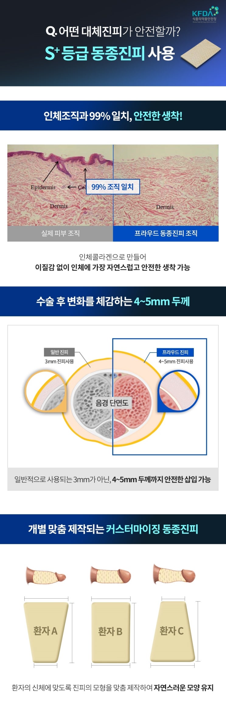  비뇨기과 전문의가 알려주는 남성수술 Q&A