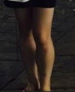  종아리 근육 종아리 알 원인 종아리 알 빼기 마사지 성공한 나만의 팁 비포 에프터 사진 99kg에서 42kg까지 다이어트 성공