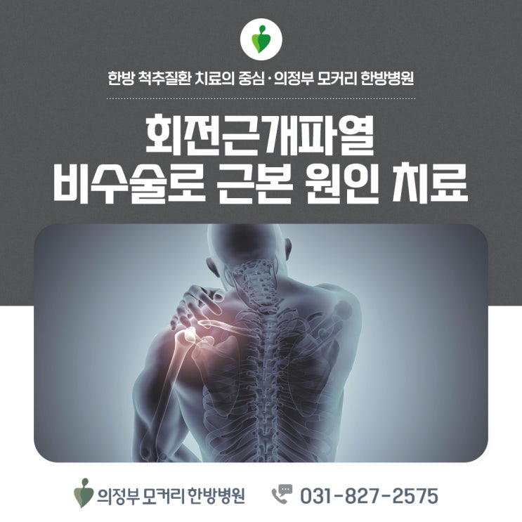  의정부모커리한방병원 회전근개파열 원인 증상 치료