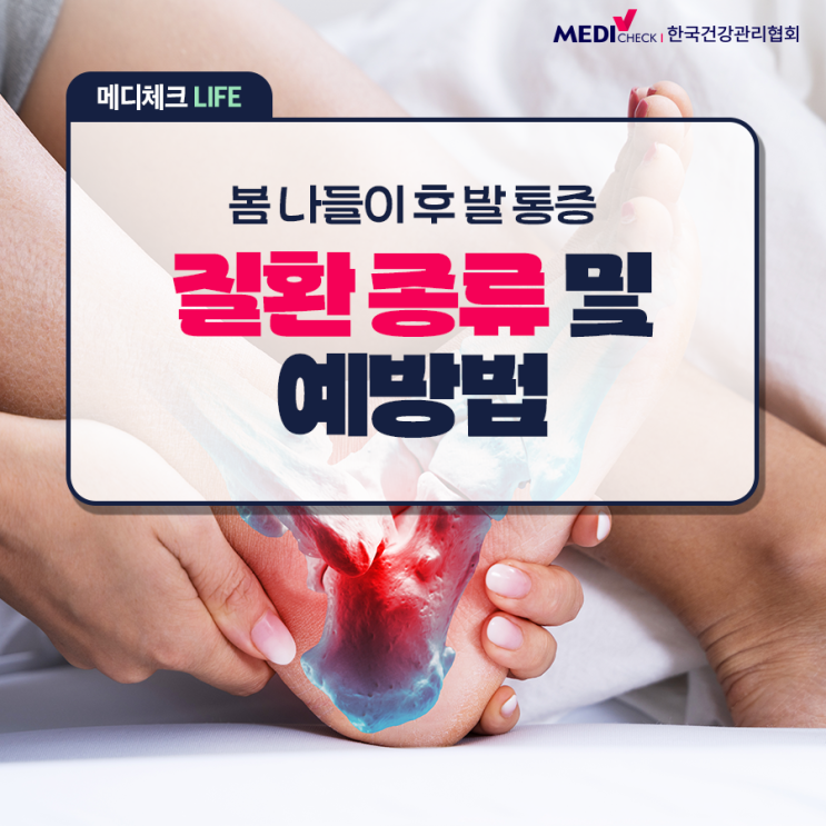  [건강정보] 봄나들이 후 발 통증, 붓기가 있다면 의심해야 할 질환과 예방법 알아보기