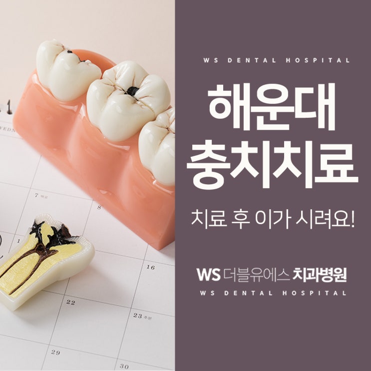  해운대좌동치과 충치치료 후 이가 시려요!