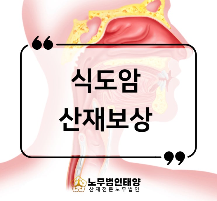  식도암 위암 산재 유기용제 노출 직업성암 승인사례