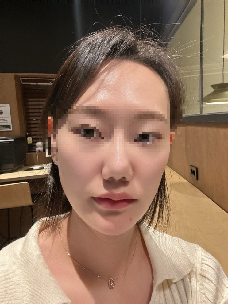  센텀시티피부과 스킨부스터 잘하는 부산피부과