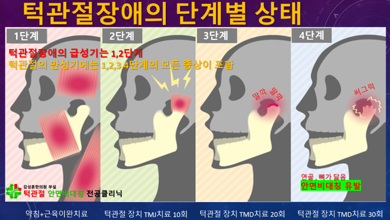 나의 턱관절장애는 5가지 유형 중 어디에 속할까? 광주턱관절병원