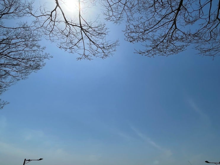  아이 내사시 진단, 불안한 마음 | 5편
