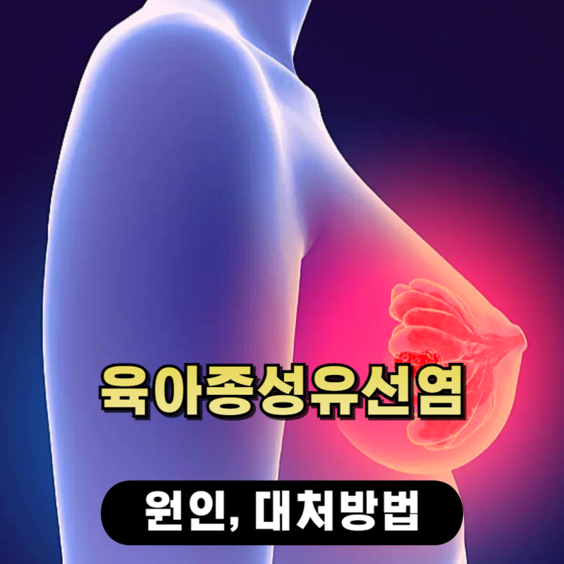 육아종성유선염 치료해도 완치가 힘든 원인, 대처하려면