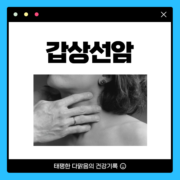 갑상선암 증세 원인 증상 갑상선 암 생존율 치료