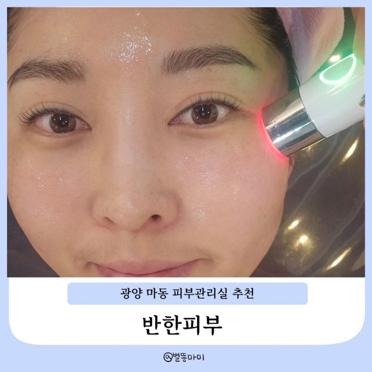  광양 마동 피부관리 반한피부 아프지 않고 효과좋은 MTS