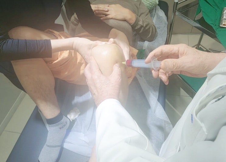 교보생명의 황당한 의료자문회신서…'무릎 시술' 보험금 미지급 사유 봤더니 교보생명의 황당한 의료자문회신서…'무릎 시술' 보험금 미지급 사유 봤더니