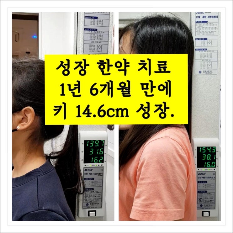  평균보다 빠른 성장속도, 1년 6개월간 14.6cm 키가 큰 사례
