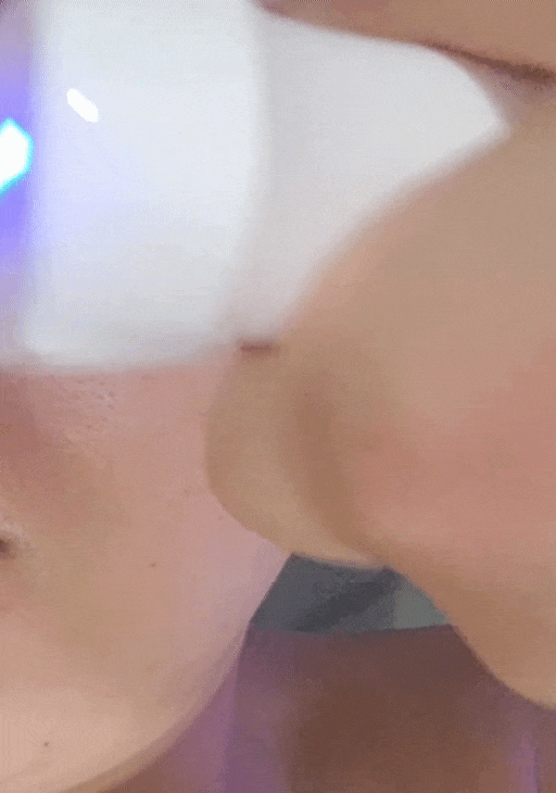  대구 성서 피부관리실 후스킨앤바디 모공 관리를 꼼꼼하게