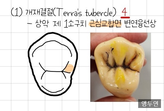 소구치 형태학, 소구치 구별, 상악 소구치, 하악 소구치, 치아형태학 8탄 : 네이버 블로그