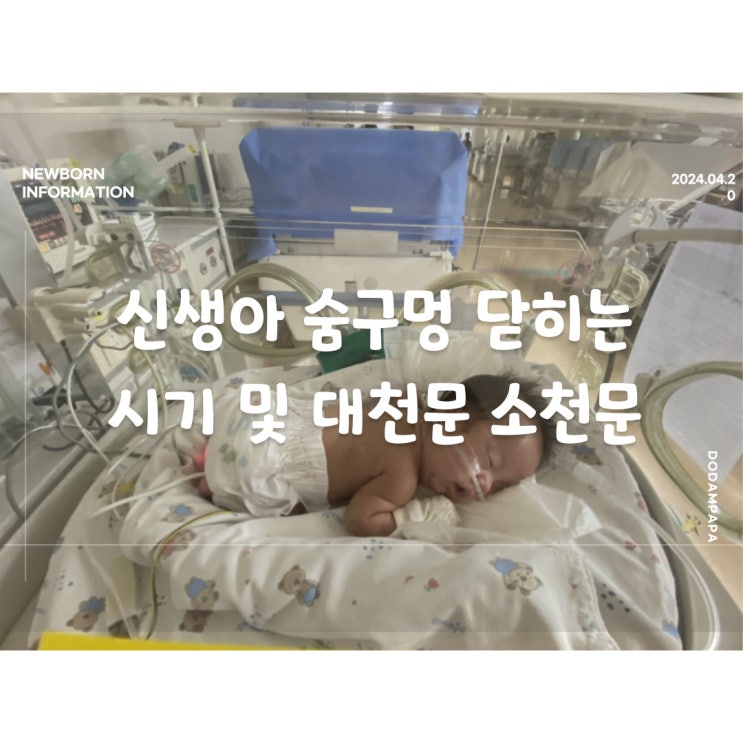 신생아 숨구멍 닫히는 시기 대천문 소천문 신생아 숨구멍 닫히는 시기 대천문 소천문