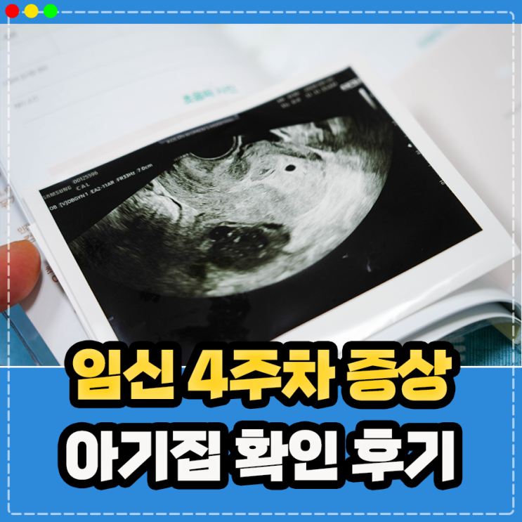  임신 4주차 증상 갈색혈 아기집 확인 후기, 아기수첩 임신사실확인서 발급