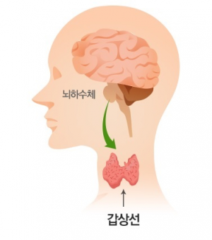  갑성선에 질환에 걸리는 이유?