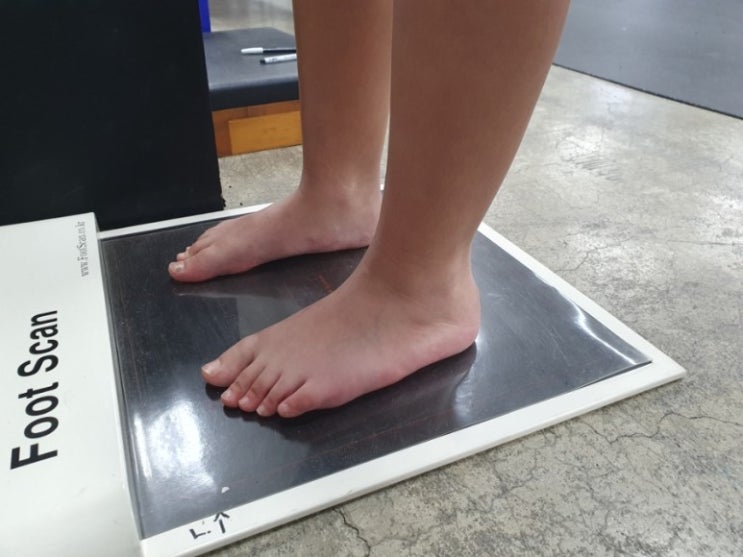  우리 아이 발, 새끼발가락이 들려져 있다면 조기에 교정하는 것이 중요합니다.