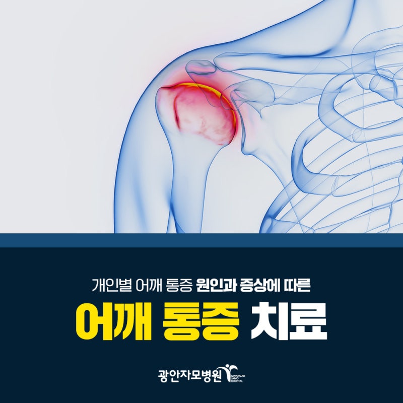 부산어깨통증병원의 원인과 증상, 치료방법은 무엇인가요?