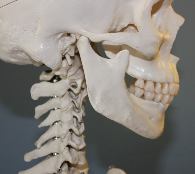 이갈이가 심해도 교정할 수 있나요? 이갈이와 치아교정 (bruxism)