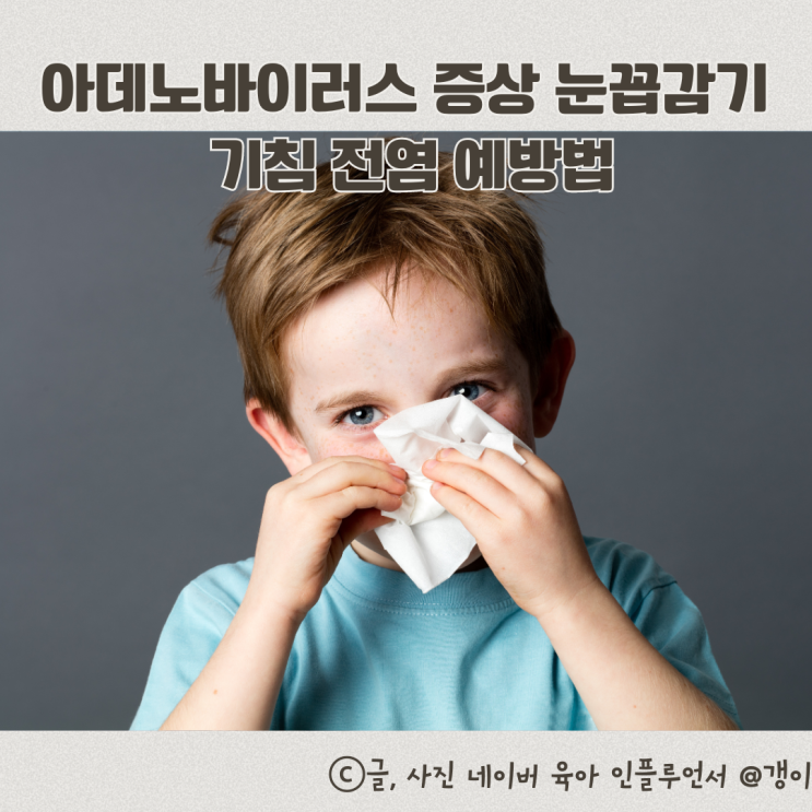  아데노바이러스 증상 아기 눈꼽감기 기침 전염 예방법