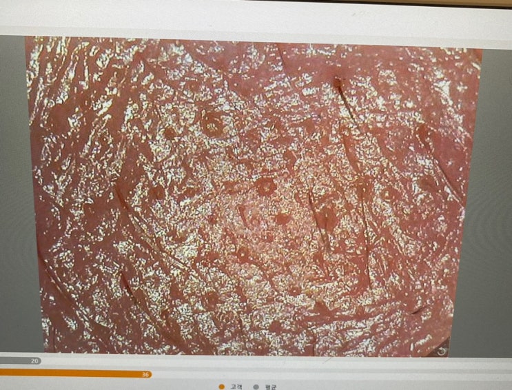  예민해진 피부 연예인도 반한 바로 그 재생크림
