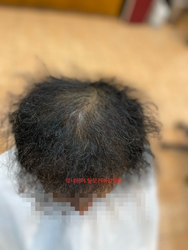  성형펌과해독컬러 니 놀랬제 남자탈모펌 잘하는 부산사상르네시떼미용실/ 사상구진구북구김해시서구암남동구중구사하구해운대구동래구동구경남경북남해거제구미연제구