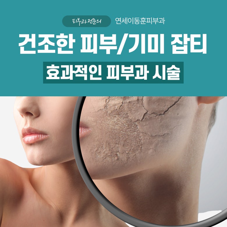 [순천 연세이동훈피부과] 건조한 피부를 막는데 효과적인 시술은?