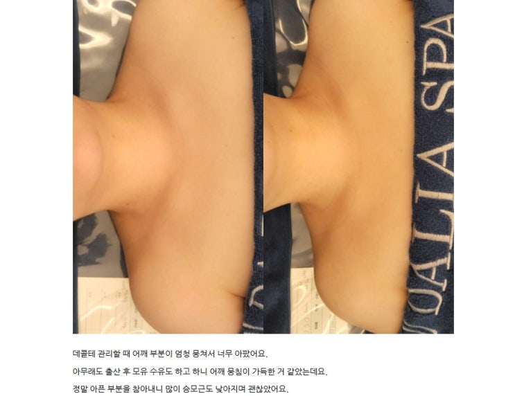  서면 신부관리 승모근관리 쇄골관리 -달리아스파 작은얼굴추천by.리안