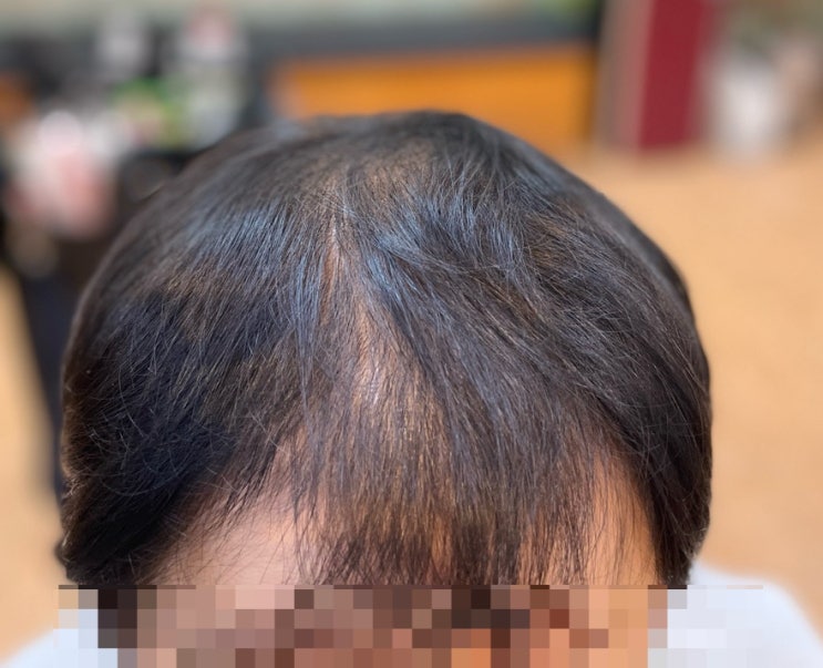  탈모커버성형펌 모류교정펌 뿌리펌 최다시술많은 부산사상구미용실르네시떼6층사상홈플러스7층위치/  사상괘법덕포덕천모라백양만덕주례감전화명용원양산진해서면전포양정망미연제동래사직금정장전범일