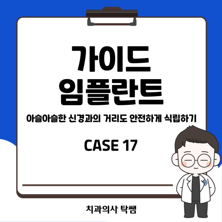  [탁쌤 CASE 17] 청주 아슬아슬한 신경과의 거리도 문제없이 가이드 임플란트 수술로 안전하게!
