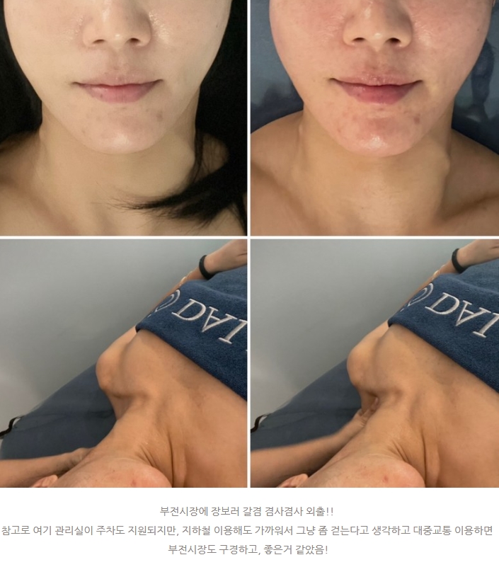 부산서면 에스테틱 약손명가브랜드 달리아스파가 최고!!!by.시소