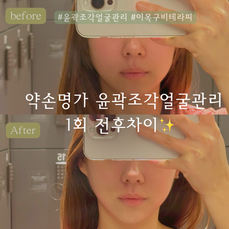  약손명가 뚝섬역점 | 윤곽조각관리 비포 애프터 성수피부관리 에스테틱 추천